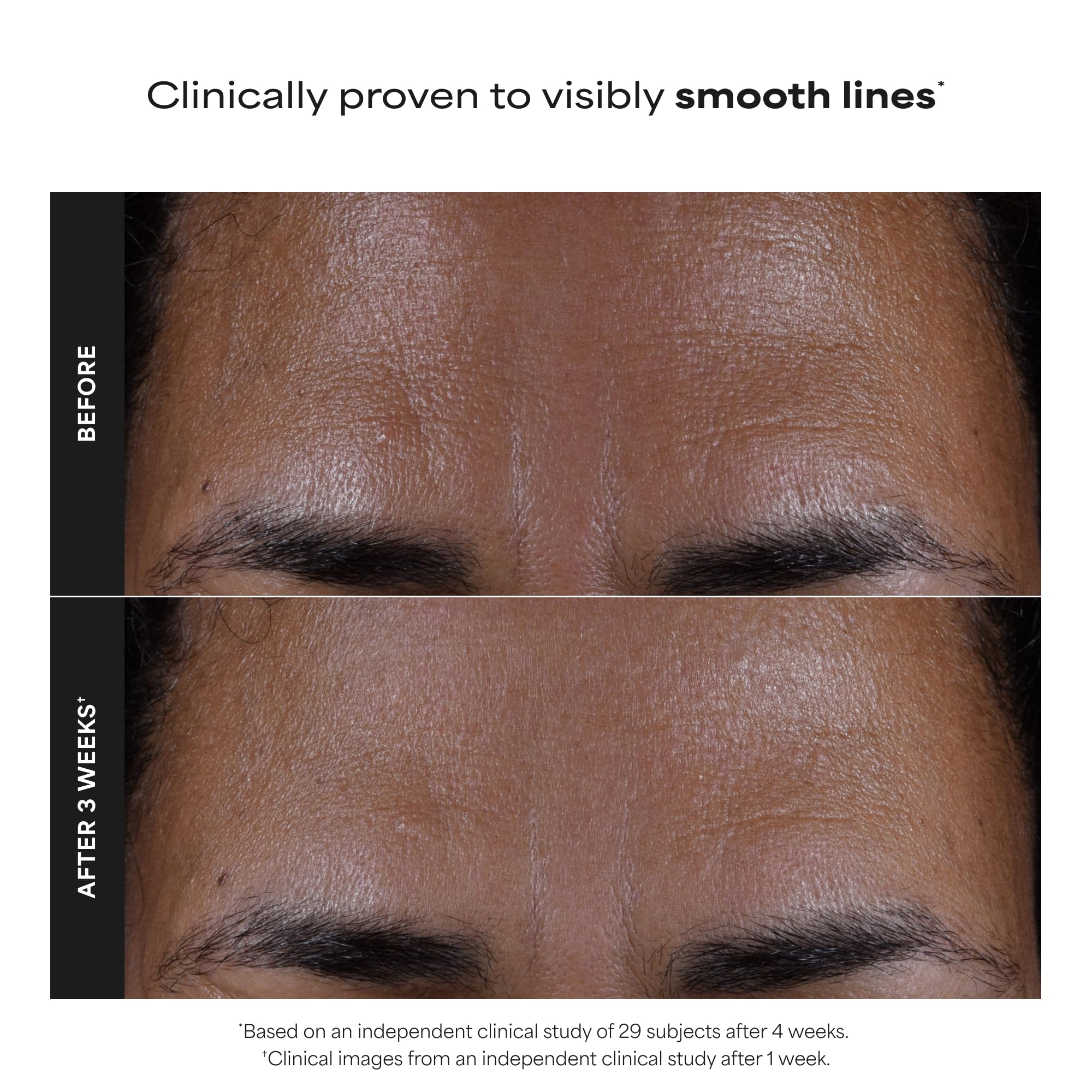 Paula’s Choice 2% BHA Liquid Exfoliant for Clearer Skin