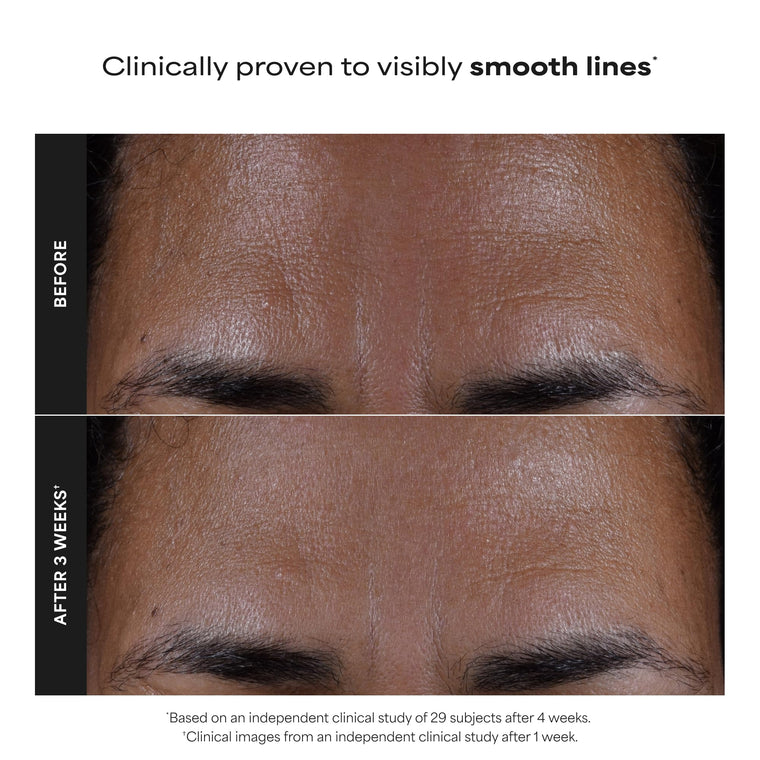 Paula’s Choice 2% BHA Liquid Exfoliant for Clearer Skin