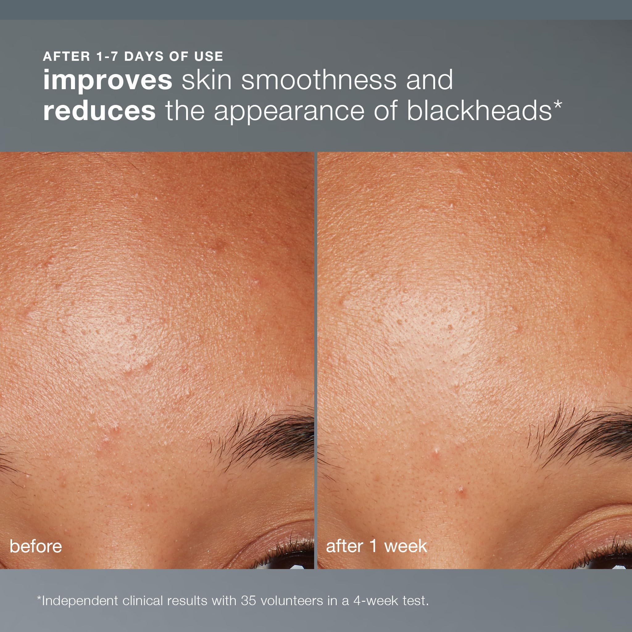 Dermalogica Daily Microfoliant Salicylic Face Exfoliator