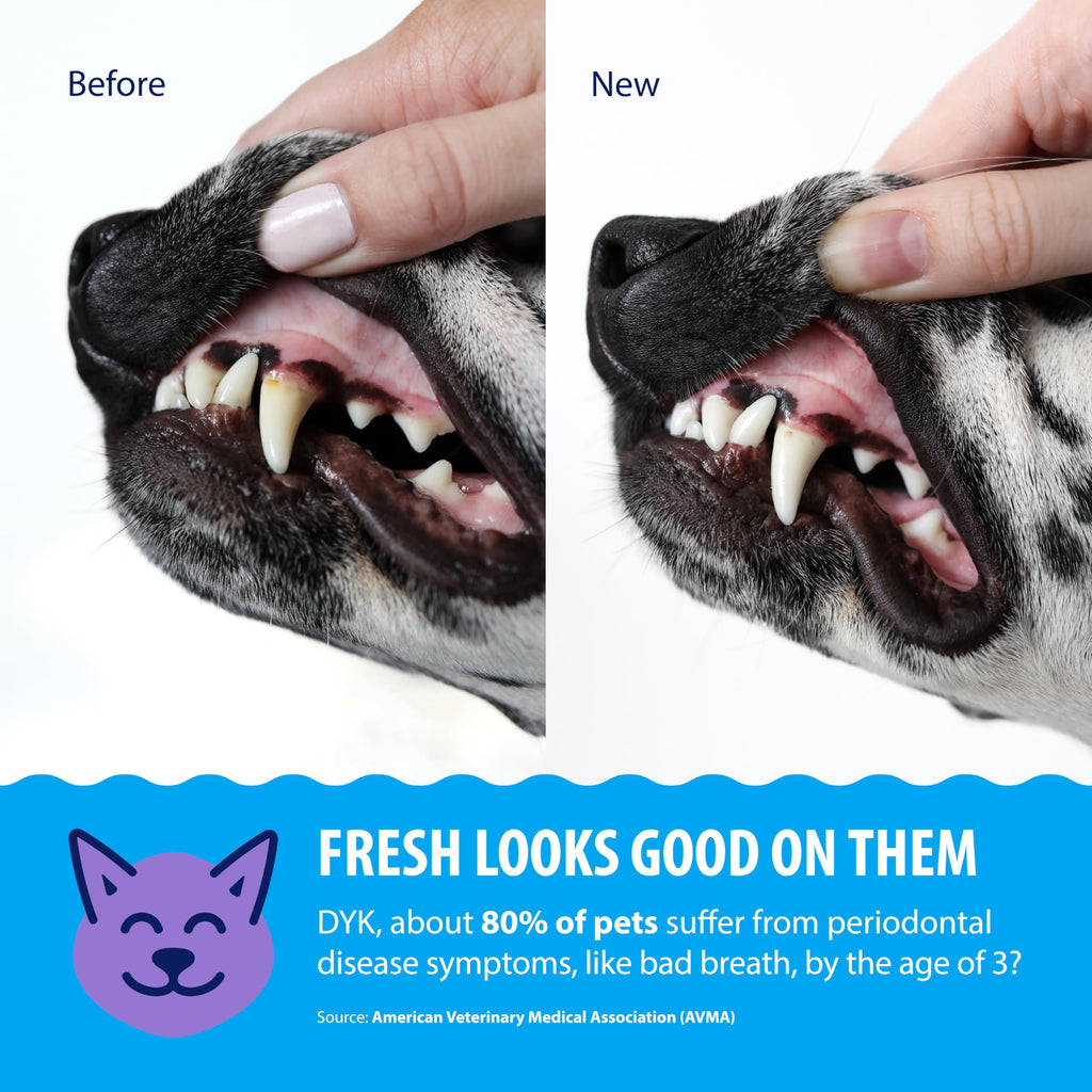 Plaque and Tartar Removal Dental Cleaning Treatment