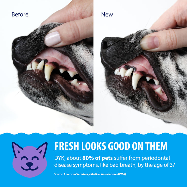 Plaque and Tartar Removal Dental Cleaning Treatment