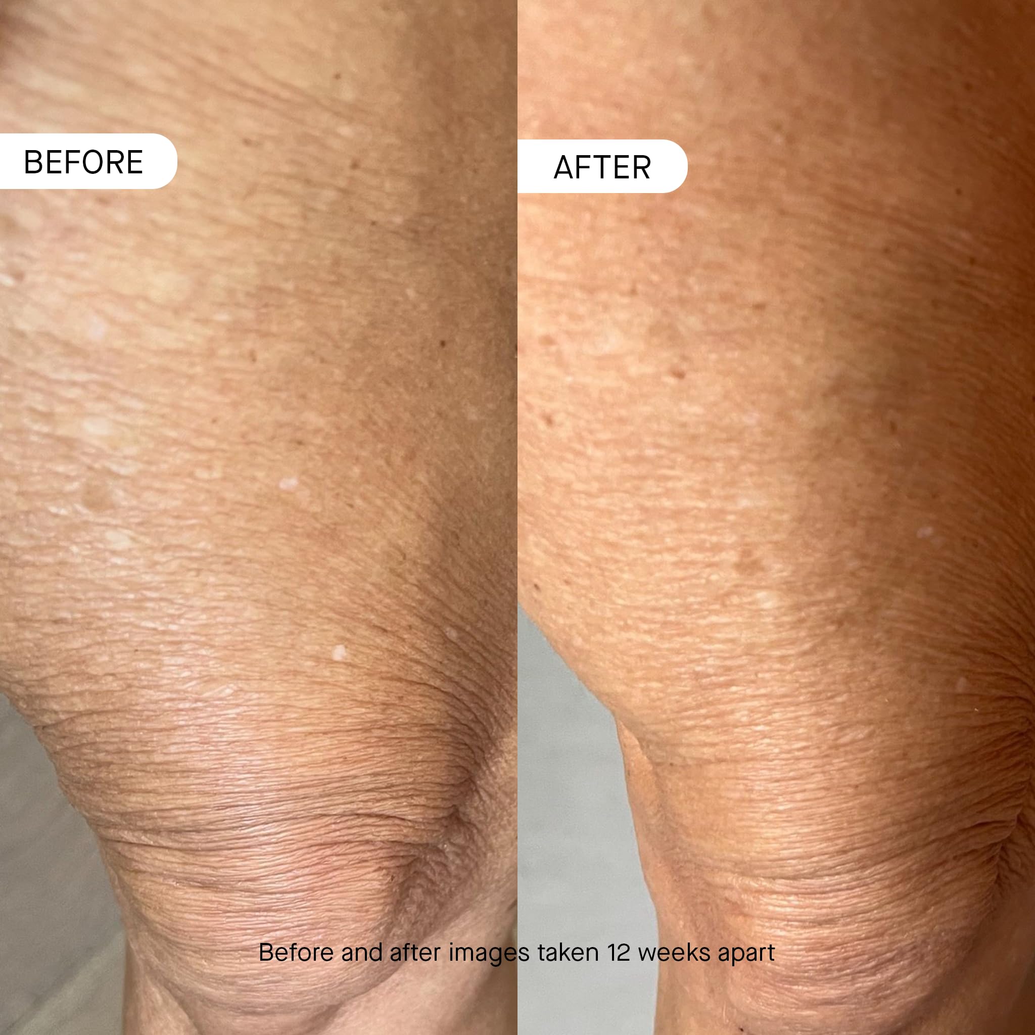 OneSkin OS-01 BODY Age-Reversal Moisturizer, 8.45 Oz