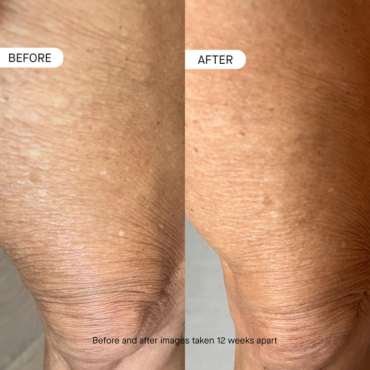 OneSkin OS-01 BODY Age-Reversal Moisturizer, 8.45 Oz